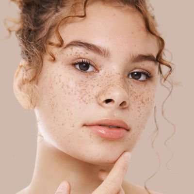 Pigmentation 2 Pigmentation 2